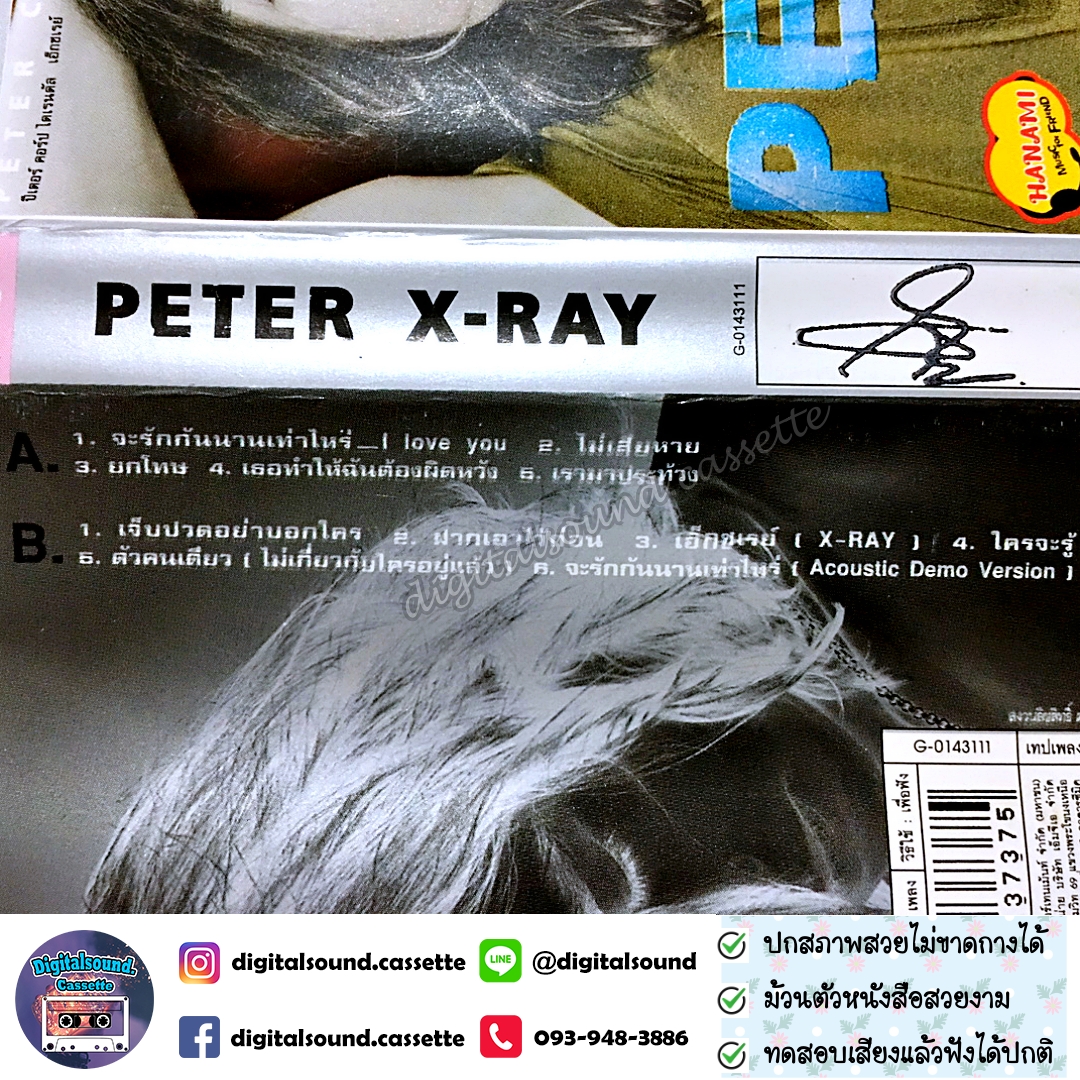 ม้วนเทป ปีเตอร์ คอร์ป ไดเรนดัล Peter Corp Dyrendal อัลบั้ม X-Ray